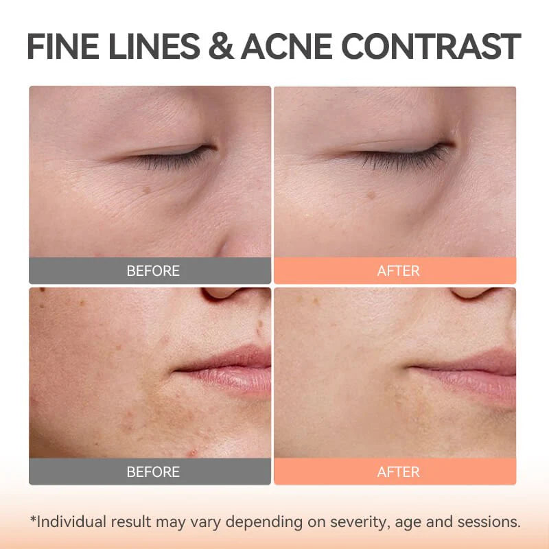 TOUCHBeauty GLAM — Máscara LED