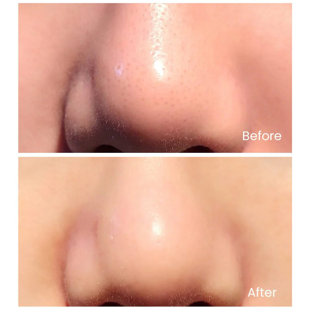 TOUCHBeauty GLOW — Exfoliación Ultrasónica