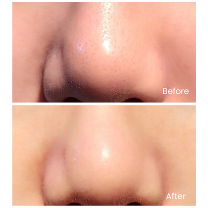 TOUCHBeauty GLOW — Exfoliación Ultrasónica